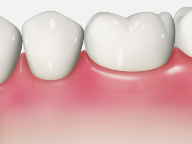 浦安市の歯医者 矯正歯科 あらかわ歯科医院 歯周病治療