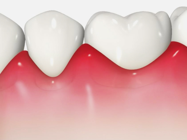 浦安市の歯医者 矯正歯科 あらかわ歯科医院 歯周病治療