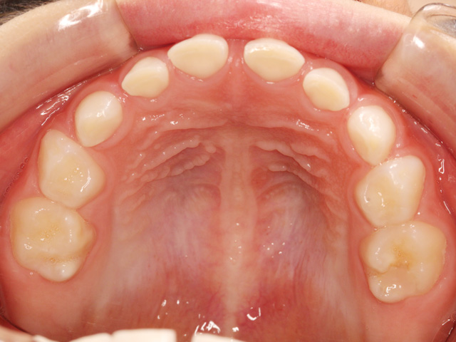 浦安の歯医者 矯正歯科 あらかわ歯科医院 小児矯正