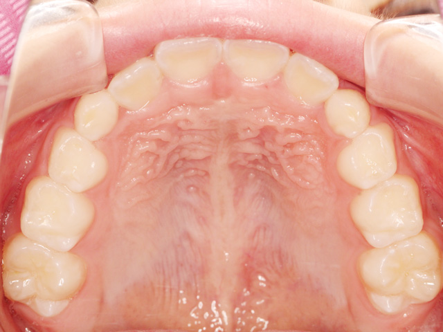 浦安の歯医者 矯正歯科 あらかわ歯科医院 小児矯正