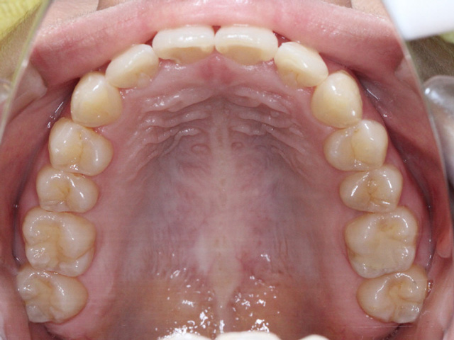 浦安の歯医者 矯正歯科 あらかわ歯科医院 小児矯正