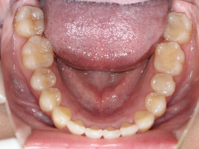 浦安の歯医者 矯正歯科 あらかわ歯科医院 小児矯正