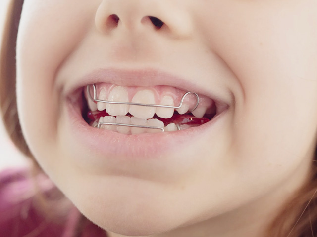 浦安の歯医者 矯正歯科 あらかわ歯科医院 小児矯正