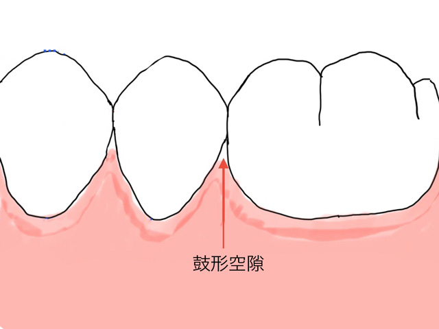 浦安市の歯医者 矯正歯科 あらかわ歯科医院 デンタルフロスが臭う理由